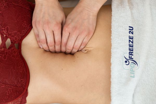 diastasis recti treatment Merseyside