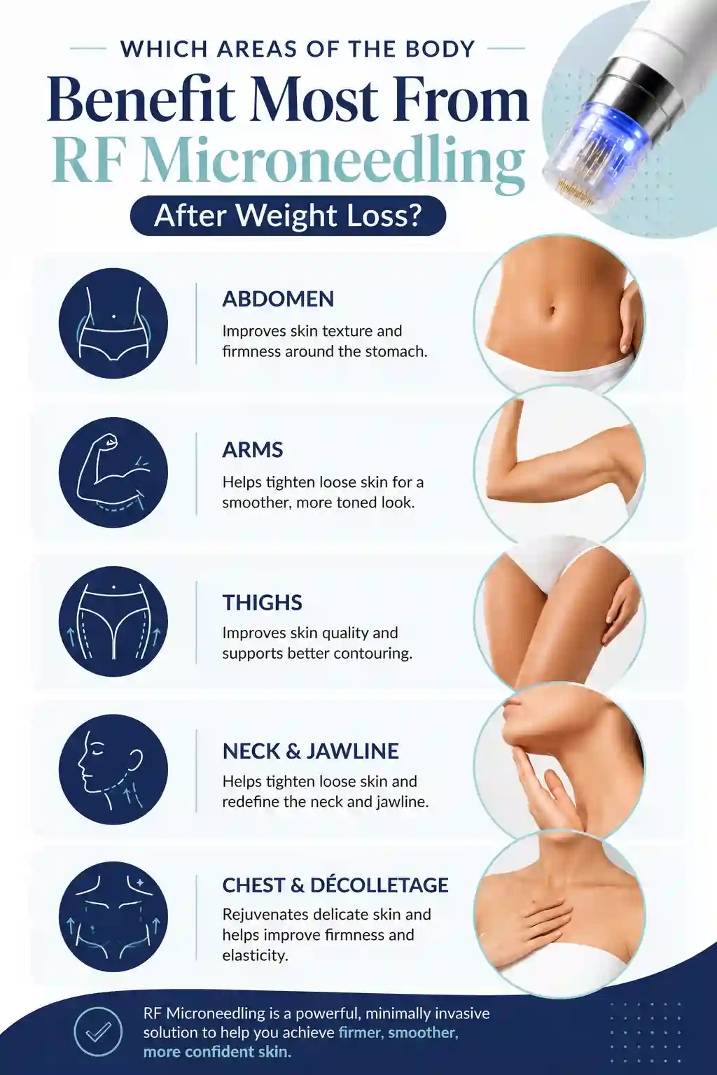 Which Areas of the Body Benefit Most From RF Microneedling After Weight Loss Merseyside